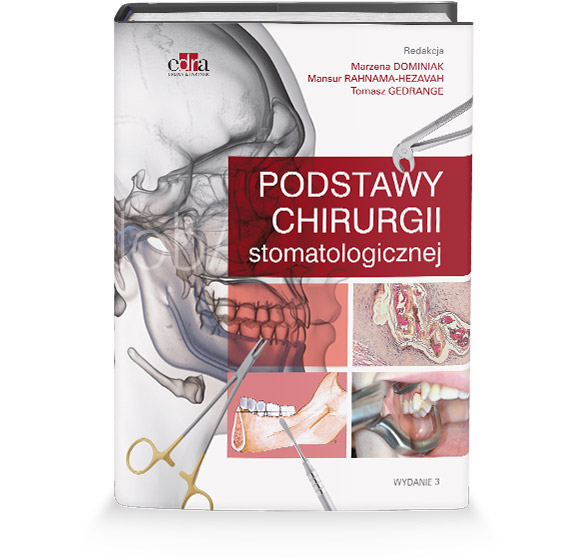 Podstawy Chirurgii Stomatologicznej